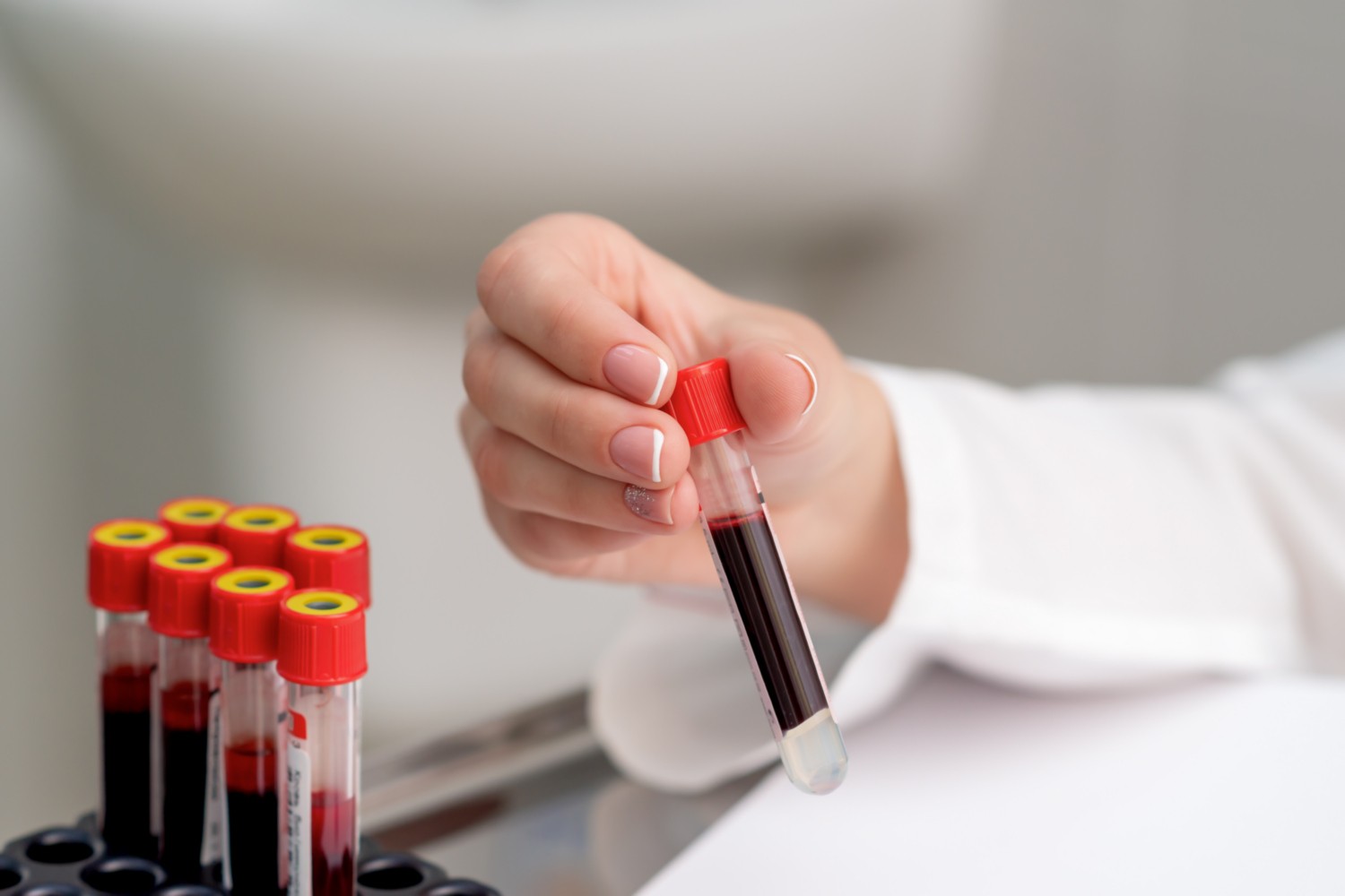 Биохимический анализ крови: расшифровка