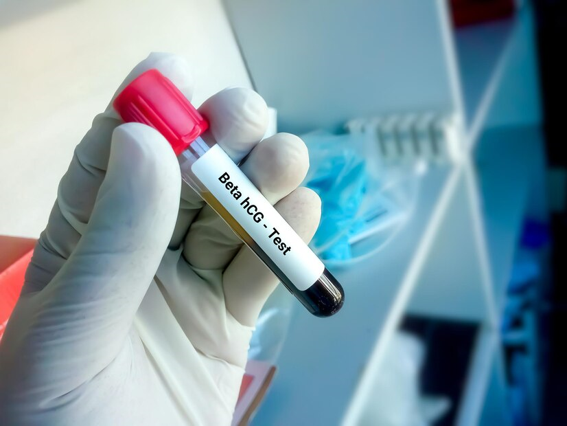 Хорионический гонадотропин человека хгч бета хгч б хгч human chorionic